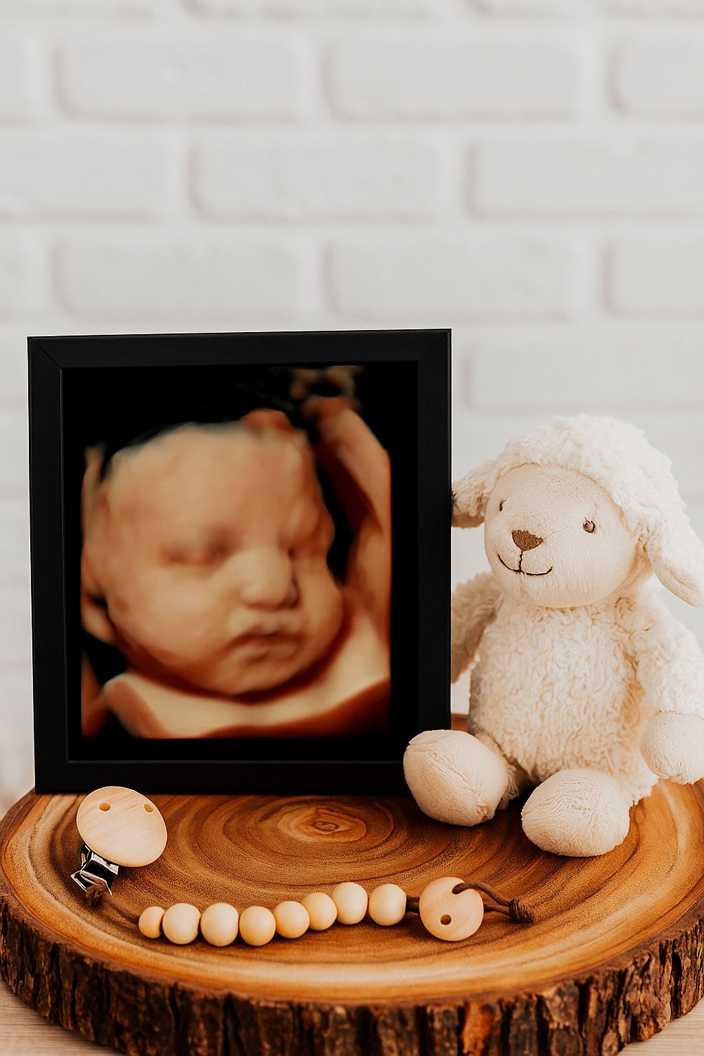 3D/4D Ultrasounds | Typically 26+ Weeks
