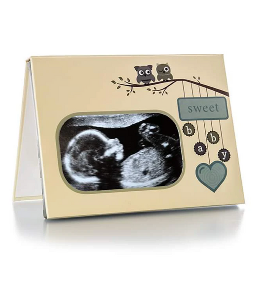 Ivory Recordable Ultrasound Frame image 0