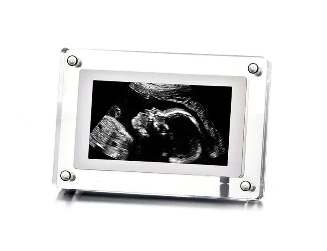 Digital Ultrasound Frame image 0