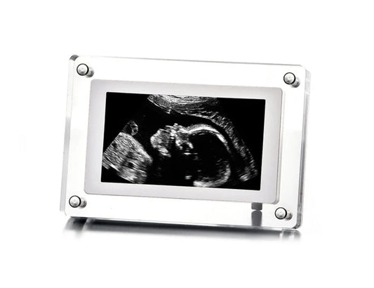 Digital Ultrasound Frame image 0