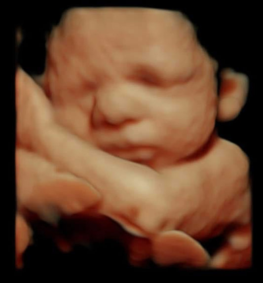 Hello Baby Premium with Heartbeat Bear and 8K Photo