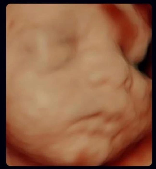 See My Sweet Pea